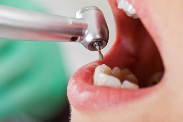 Professional Emergency Dentist in WI